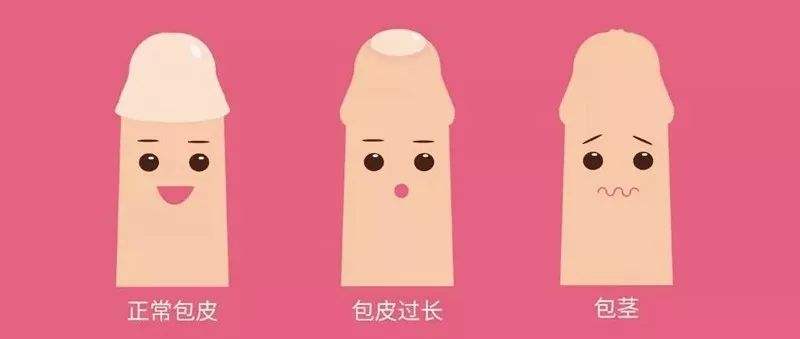 包皮过长